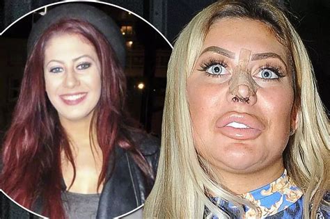 chloe geordie|chloe ferry before and after.